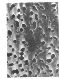 Fig. 1. Electron rnicrograph of B-CTA ultrafiltration membrane (3000 x 1 of cast solution.