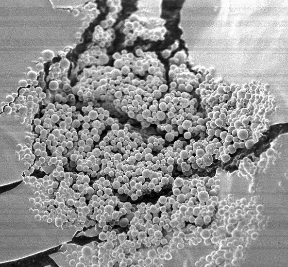 SEM Colloidosome microcapsules - scale