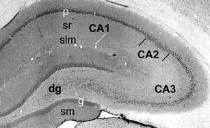 25 Figure 8. Coronal section of rat hippocampus.