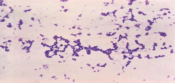 C. Gram Staining: used to distinguish different types of bacteria 1) Gram (+): thick cell wall, absorb lots of purple
