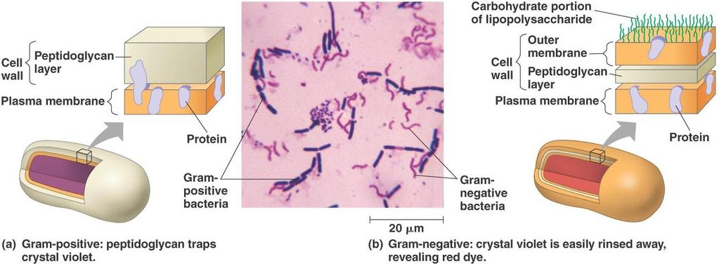 III. Bacterial cell wall made of carbohydrate polymers that are connected by polypeptide chains (peptidoglycan).