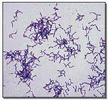 Gram positive bacteria Gram negative bacteria Have an extra layer of