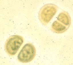 V. Cyanobacteria Unicellular, filamentous, colonial packets in mucilage Figure