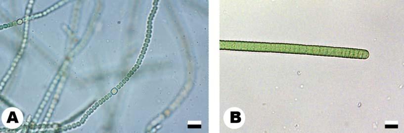 Wallace. 2012. Algae in forensic investigations.