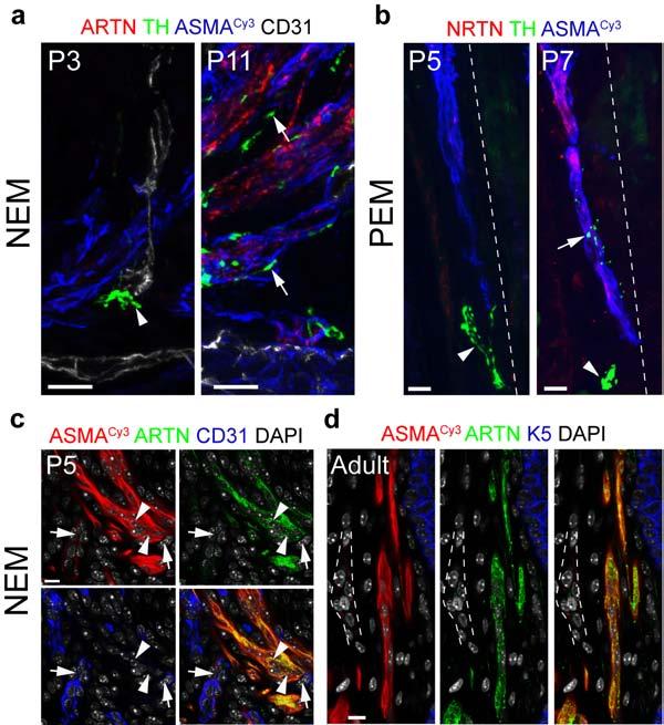 Supplementary Figure 7 The onset of ARTN and NRTN expression in the nascent erector muscles is paralleled by downregulation of ARTN in the blood vessels and coincides with target innervation by