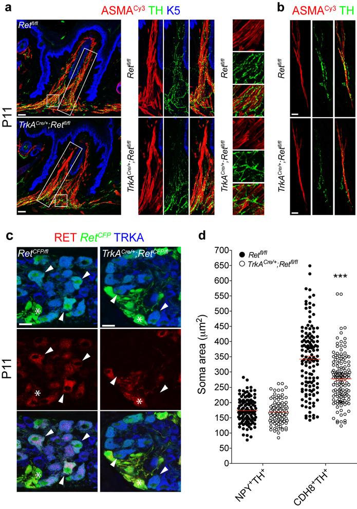 Supplementary Figure 9 A role for Ret in EMN differentiation and for NEM and PEM innervation. (a, b) NEM and PEM innervation is compromised in Ret-deficient mice.