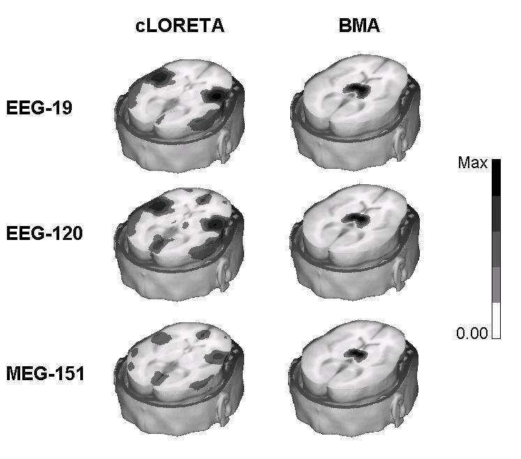 Figure 12. 3D reconstructions of the absolute values of BMA and cloreta solutions for the TH source case.