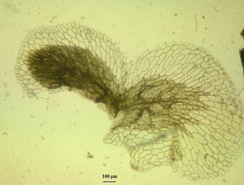 13) the superior epidermis of the foliar lobes differentiates unicellular, papilliform trichomes (Fig. 14), ~50 µm long, similar to the ones observed at Azolla filiculoides.
