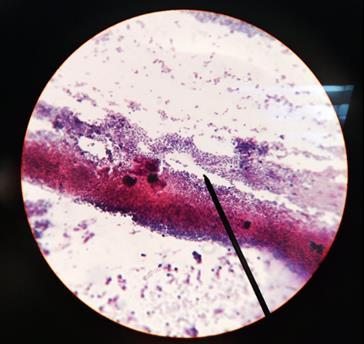 under 1000X Figure 6: Gram-stained