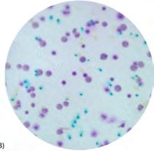 Enterococcus faecalis (29212) 15713 Universal Food pathogen ID Membrane Bacillus cereus (10876) Listeria monoyctogenes (19111) Escherichia coli O157:H7 (NCTC 12900) Shigella flexneri (12022)