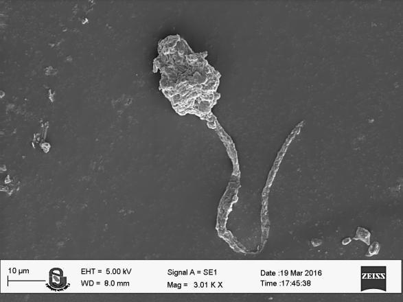 Fig.6 SEM image of AMF spore Fig.