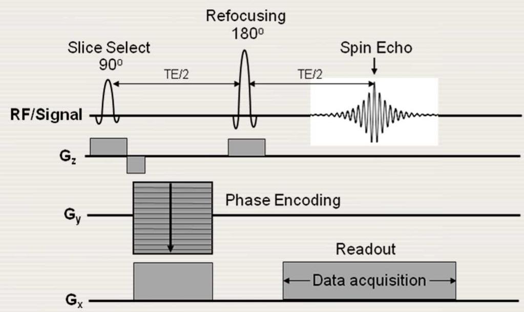 14.5 SPATIAL ENCODING AND BASIC PULSE SEQUENCES 14.5.5 Spin echo imaging Spin echo pulse sequence The spin echo sequence is similar to the gradient echo sequence phase-encoding, rewinder and prephase