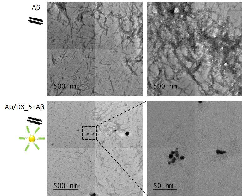 4. Results and Discussion 165 1 µm in the absence of the nanoconjugates. The addition of AuNP/D3_5+ conjugates resulted in fewer and shorter fibril fragments.