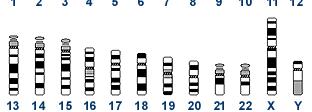 chromosomes 13, 14, 15 21, 22 autosomes