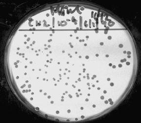 Light microscopy Class Halobacteria.