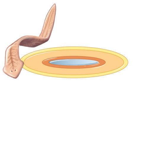 pseudocoelom  endoderm) B Roundworms have a fluid-filled pseudocoelom.