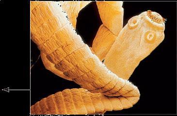 larval tapeworm