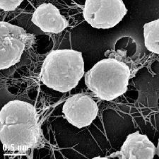 The study of microorganisms is called microbiology, a subject that began with Anton van Leeuwenhoek's discovery of microorganisms in 1675, using a microscope that he built himself.