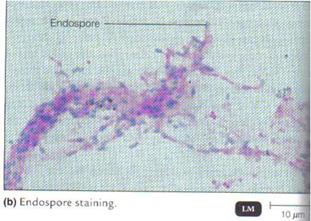 Endospore Stain: Primary: basic stain Rinse: removes stain from Counterstain: basic stain colors 2/4/2013 Ch 3 & 4 Microscopy & Cell Componenets 37 2/4/2013 Ch 3 & 4