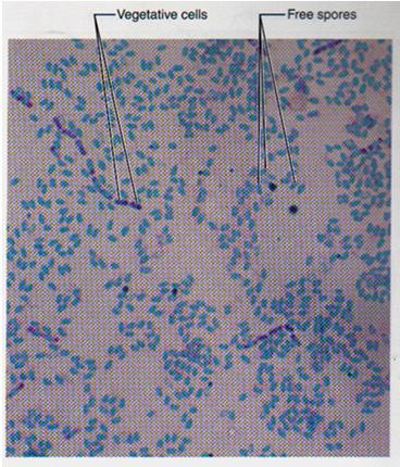 Componenets 18 Stains; Endospore Pictures Stains; Flagella 10.