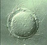 Fertilization Comparison of Meiosis with A. Involves the fusion of two gametes B.