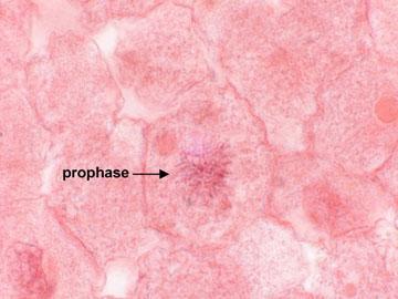 Phases of Mitosis: Prophase First & longest phase Chromosomes