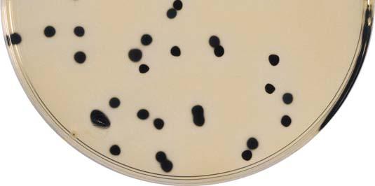 Clostridium perfringens Typical aspect Black colonies, often surrounded by a black precipitate TSC Agar (use