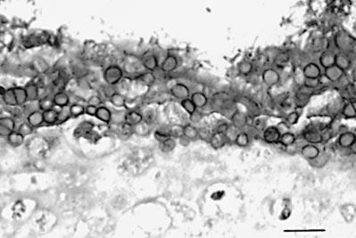 744 JOURNAL OF WILDLIFE DISEASES, VOL. 39, NO. 3, JULY 2003 FIGURE 3. Immunohistochemical staining of digit of D. tinctorius showing intense chytrid infection in skin. Bar 100 m.