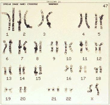 chromosome number: aneuploidy Changes in number of individual chromosomes, relative to the normal diploid number of two.
