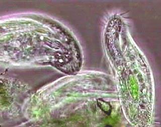 Protozoa: mostly unicellular organisms with animal-like characteristics and are commonly 5 to 50 mm in size.
