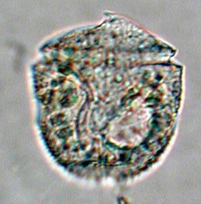67 benthic species of dinoflagellates: 17