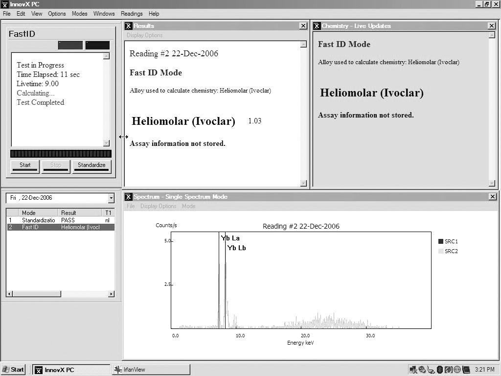 BUSH ET AL. RESTORATIVE RESIN DATABASE 423 FIG. 3 Screen capture from analysis with portable XRF. The unknown is correctly identified as Heliomolar.