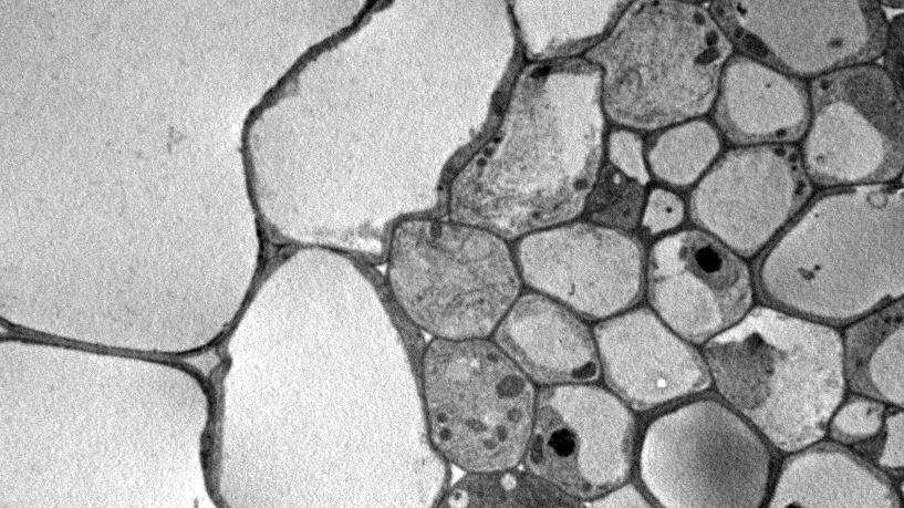 Ph Co En Pe Xy Supplemental Figure 4. Electron micrograph of transverse section of J2731*UASGAL4:AtHKT1;1 root.
