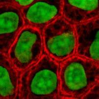 Cell Diversity Cell Specialty: Cover and Line Body Organs Type of Cell: Epithelial