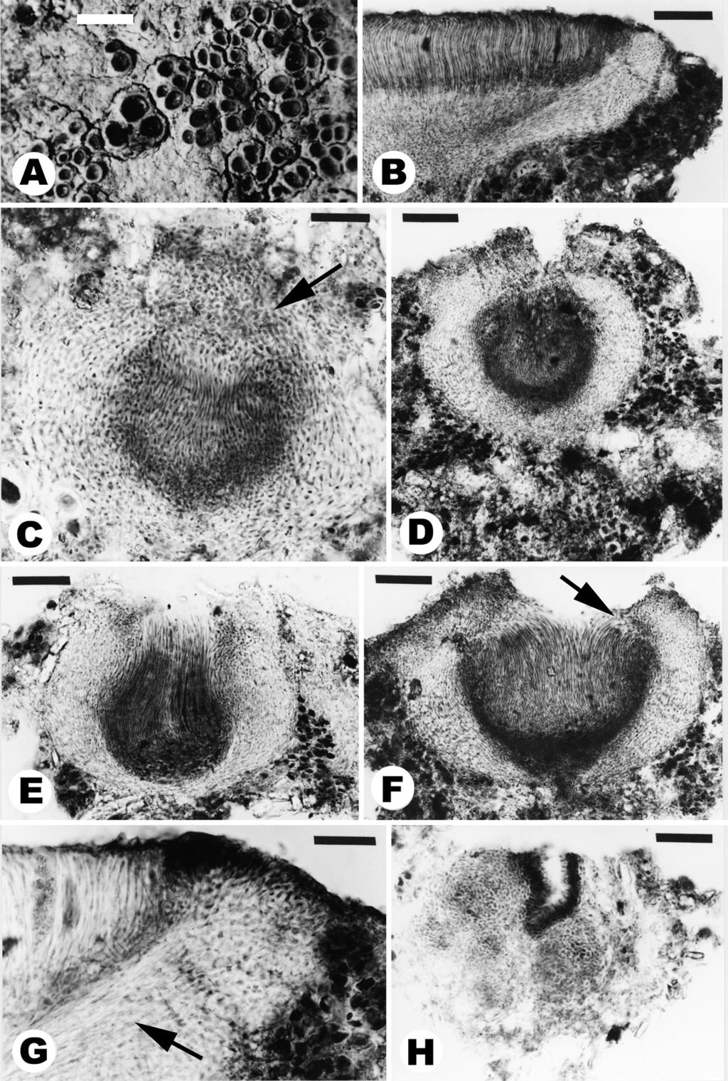 282 Henssen & Lücking ANN. BOT. FENNICI Vol. 39 Fig. 6. Apothecial anatomy and ontogeny in Gyalidea lecanorina (New Zealand, Henssen 30360a; B H microtome sections in LB).