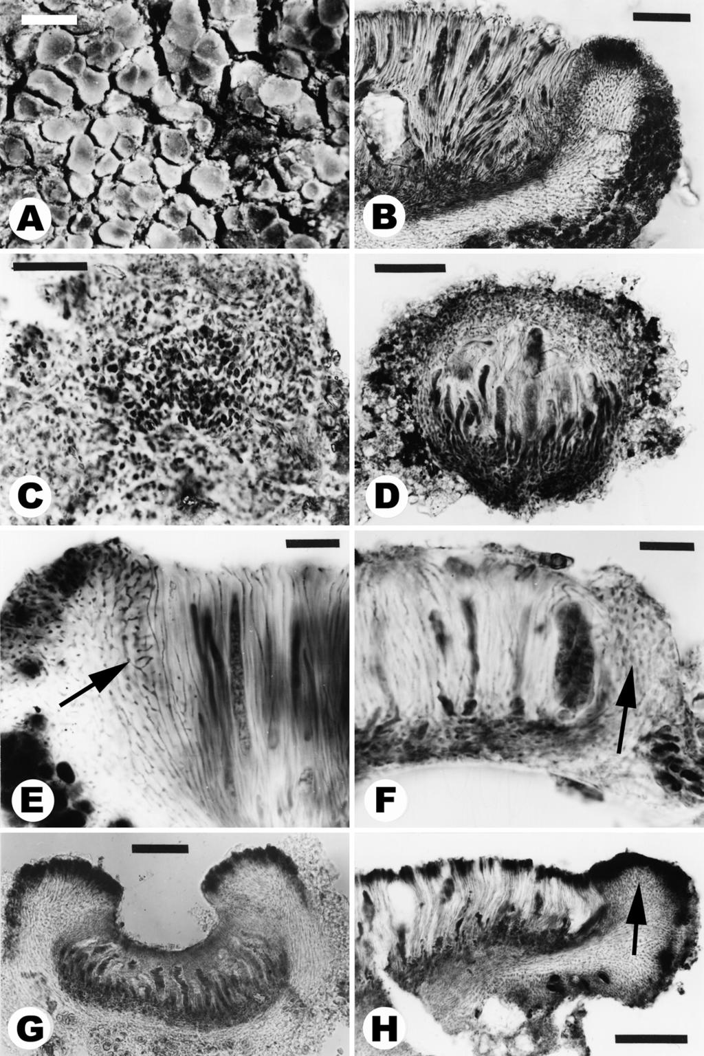 ANN. BOT. FENNICI Vol. 39 Ontogeny of Asterothyriaceae 283 Fig. 7. Apothecial anatomy and ontogeny in Gyalidea (B H microtome sections in LB). A E: Gyalidea hyalinescens.