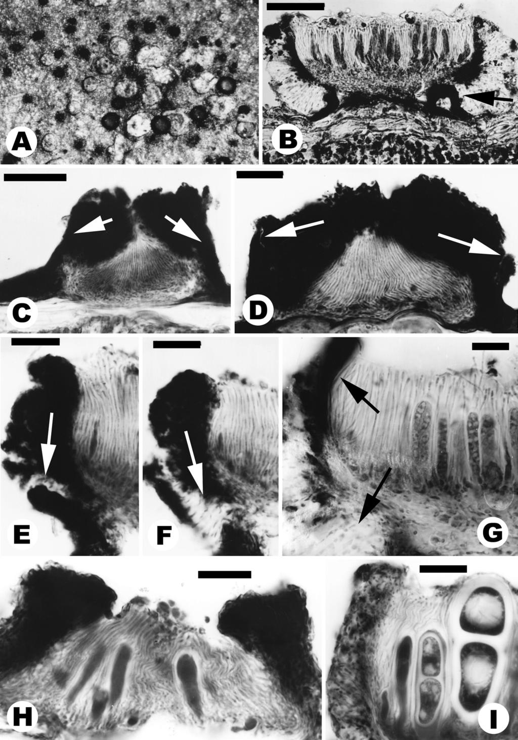 ANN. BOT. FENNICI Vol. 39 Ontogeny of Asterothyriaceae 285 Fig. 8. Apothecial anatomy and ontogeny in Psorotheciopsis (B I microtome sections in LB). A G: P. patellarioides (Guinea, Lisowski s.n.; Vezda: Lich.