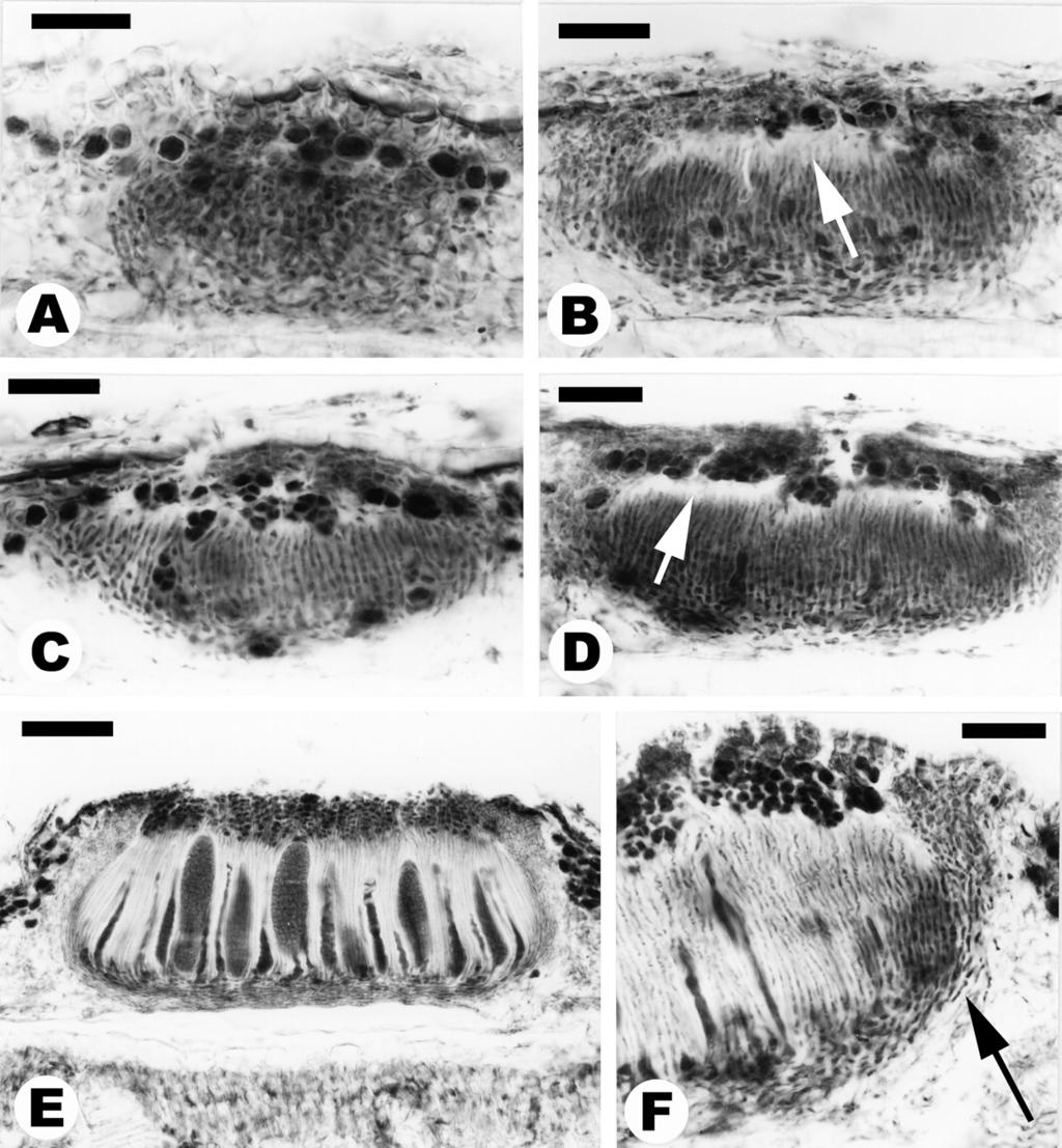 290 Henssen & Lücking ANN. BOT. FENNICI Vol. 39 Fig. 12. Apothecial anatomy and ontogeny in Asterothyrium rotuliforme (microtome sections in LB; A D: Costa Rica, Lücking 92-2; E F: Brazil, Rick s.n.).