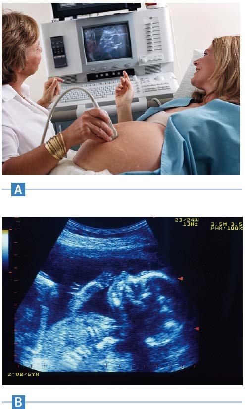 Ultrasound Images Ultrasonic imaging uses sound waves to obtain images inside a material The most familiar use is to produce views inside the human body The depth of