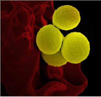KINGDOM EUBACTERIA : Staphylococcus aureus Prokaryotic