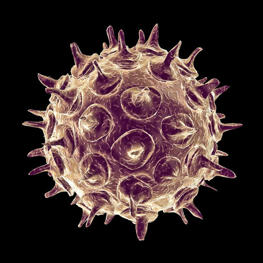VIRUS - Varicella (chicken pox) Non-living Non- cellular