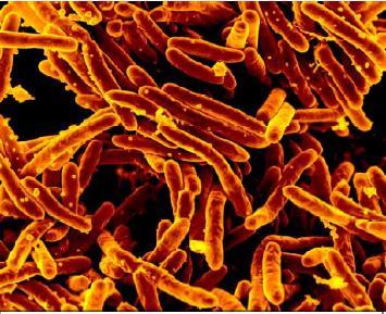 KINGDOM EUBACTERIA : Mycobacterium: Tuberclurosis