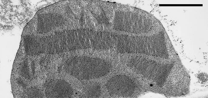Figure 1: Electron micrographs of a chloroplast from a Alocasia macrorrhiza at low irradiance,10 µmole photons m -2 s -1. (Adapted from Chow et al.