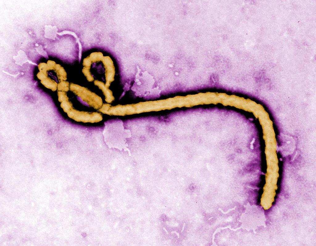 VIRUS - Ebola Non-living Non- cellular Protein coat
