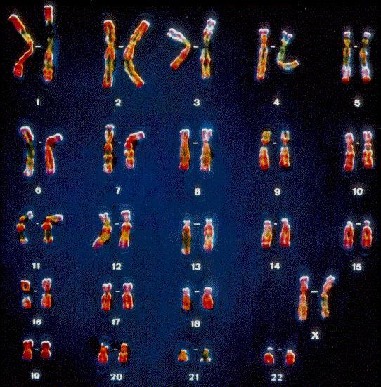 Karyotype A display of the 46 human