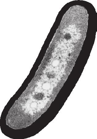 Prokaryotic cells Prokaryotic cells are bacterial cells. Prokaryotic cells do not have a membranebound nucleus or any other membrane-bound organelles. They are small (generally 0.