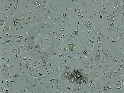 Cyanobacterial chain Scenedesmus