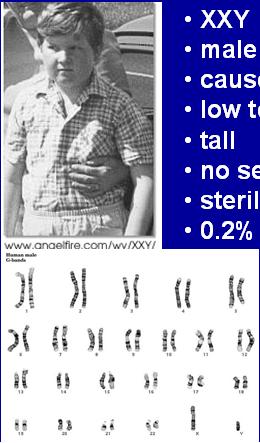 12% occurrence Normal Male Down Syndrome Male