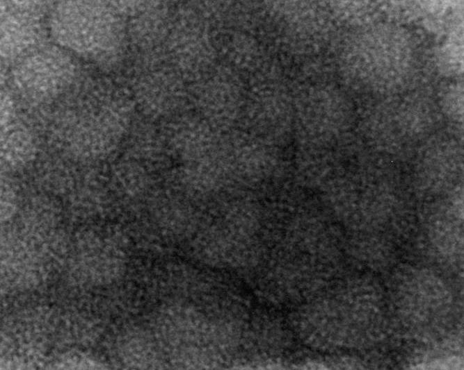nanocomposite films after Al etching TEM image