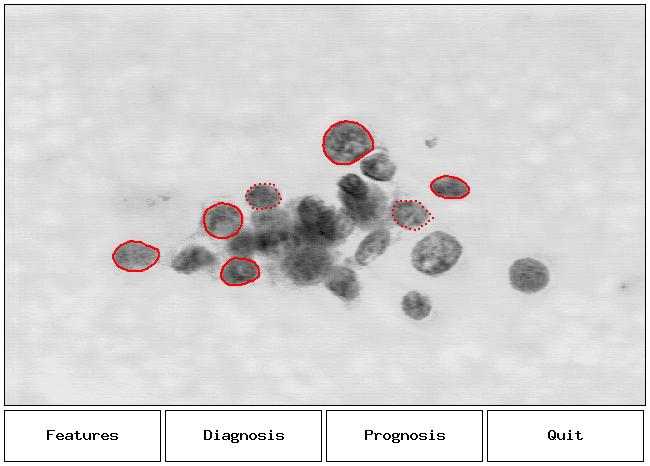 Example: A data set Cell Nuclei of Fine Needle Aspirate Cell samples were taken from tumors in breast cancer patients before surgery, and imaged Tumors were excised